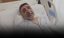 İngiliz boksörün darp ettiği taksici konuştu: "Gözlerimi oymaya çalıştı"